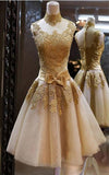 Gorgeous Lace Applique Knot Knee Length Homecoming Party Casual Dress